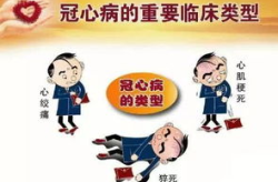 上面正差一点下面少丢一点打一字,副标题撰写技巧解析”